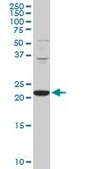 Monoclonal Anti-PCMT1 antibody produced in mouse clone 1D6, purified immunoglobulin, buffered aqueous solution