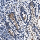 Anti-SLC38A6 antibody produced in rabbit Prestige Antibodies&#174; Powered by Atlas Antibodies, affinity isolated antibody, buffered aqueous glycerol solution