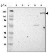 Anti-DLG5 antibody produced in rabbit Prestige Antibodies® Powered by Atlas Antibodies, affinity isolated antibody, buffered aqueous glycerol solution