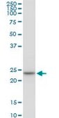 Anti-HSPC111 antibody produced in mouse purified immunoglobulin, buffered aqueous solution