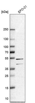 Anti-RAI2 antibody produced in rabbit Prestige Antibodies&#174; Powered by Atlas Antibodies, affinity isolated antibody, buffered aqueous glycerol solution