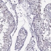 Anti-INCENP Prestige Antibodies&#174; Powered by Atlas Antibodies, affinity isolated antibody