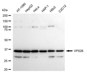 KD-Validated Anti VPS26 Antibody, clone 24GB2415, Rabbit Monoclonal clone 24GB2415, recombinant rabbit monoclonal, expressed in HEK293 cells