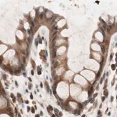 Anti-GALT antibody produced in rabbit Ab1, Prestige Antibodies&#174; Powered by Atlas Antibodies, affinity isolated antibody, buffered aqueous glycerol solution