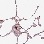 Anti-SERPING1 antibody produced in rabbit Prestige Antibodies&#174; Powered by Atlas Antibodies, affinity isolated antibody, buffered aqueous glycerol solution