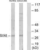 Anti-SIX6 antibody produced in rabbit affinity isolated antibody
