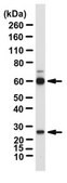 Anti-Hyaluronan synthase 3 Antibody from rabbit, purified by affinity chromatography