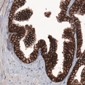 Monoclonal Anti-CTNNB1 antibody produced in mouse Prestige Antibodies&#174; Powered by Atlas Antibodies, clone CL3691, purified immunoglobulin, buffered aqueous glycerol solution