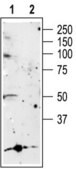 Anti-Purinergic Receptor P2X5 antibody produced in rabbit affinity isolated antibody, lyophilized powder