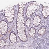 Anti-GAL3ST2 antibody produced in rabbit Prestige Antibodies&#174; Powered by Atlas Antibodies, affinity isolated antibody, buffered aqueous glycerol solution