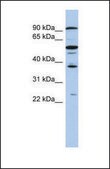 Anti-EZH1, (N-terminal) antibody produced in rabbit affinity isolated antibody