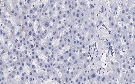 Anti-N-Cadherin Antibody, clone 3H17 ZooMAb&#174; Rabbit Monoclonal recombinant, expressed in HEK 293 cells