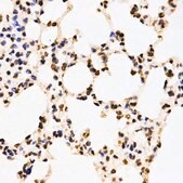 Anti-Asymmetric DiMethyl-Histone H3-R17 antibody produced in rabbit