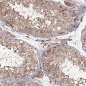 Anti-VPS26A antibody produced in rabbit Prestige Antibodies&#174; Powered by Atlas Antibodies, affinity isolated antibody, buffered aqueous glycerol solution
