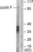 Anti-Cyclin F antibody produced in rabbit affinity isolated antibody