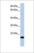Anti-GPX4 antibody produced in rabbit affinity isolated antibody