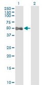 Monoclonal Anti-ALDH9A1 antibody produced in mouse clone 3C6, purified immunoglobulin, buffered aqueous solution