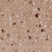 Anti-BDKRB1 antibody produced in rabbit Prestige Antibodies® Powered by Atlas Antibodies, affinity isolated antibody, buffered aqueous glycerol solution