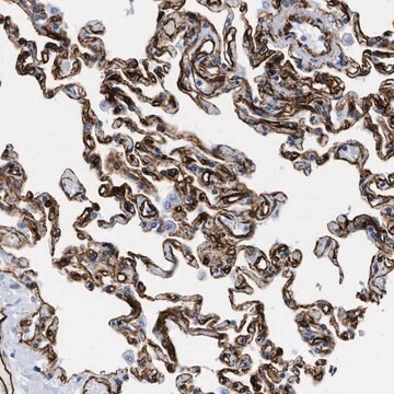 Anti-TVP23B antibody produced in rabbit Prestige Antibodies&#174; Powered by Atlas Antibodies, affinity isolated antibody, buffered aqueous glycerol solution