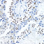 Anti-TriMethyl-Histone H3-K79 antibody produced in rabbit