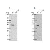 Anti-GSS antibody produced in rabbit Prestige Antibodies&#174; Powered by Atlas Antibodies, affinity isolated antibody, buffered aqueous glycerol solution