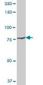Anti-POR antibody produced in mouse purified immunoglobulin, buffered aqueous solution