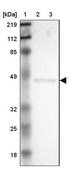 ANTI-ERP44 antibody produced in rabbit Prestige Antibodies® Powered by Atlas Antibodies, affinity isolated antibody, buffered aqueous glycerol solution