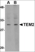 Anti-TEM2 antibody produced in rabbit affinity isolated antibody, buffered aqueous solution