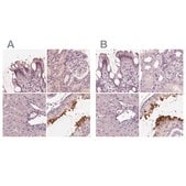 Anti-CALR3 antibody produced in rabbit Prestige Antibodies® Powered by Atlas Antibodies, affinity isolated antibody, buffered aqueous glycerol solution