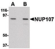 Anti-NUP107 antibody produced in rabbit affinity isolated antibody