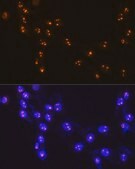 Anti-Fibrillarin/U3 RNP antibody produced in rabbit