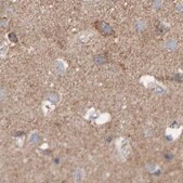 Anti-EFR3A antibody produced in rabbit Prestige Antibodies&#174; Powered by Atlas Antibodies, affinity isolated antibody, buffered aqueous glycerol solution, Ab1