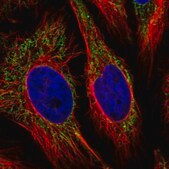 Anti-ANKRD33B antibody produced in rabbit Prestige Antibodies® Powered by Atlas Antibodies, affinity isolated antibody, buffered aqueous glycerol solution