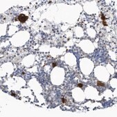 Anti-GPATCH3 antibody produced in rabbit Prestige Antibodies&#174; Powered by Atlas Antibodies, affinity isolated antibody, buffered aqueous glycerol solution