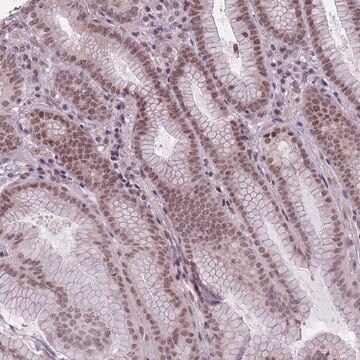 Anti-TIGD1 antibody produced in rabbit Prestige Antibodies&#174; Powered by Atlas Antibodies, affinity isolated antibody, buffered aqueous glycerol solution