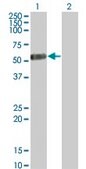 Monoclonal Anti-IL13RA2 antibody produced in mouse clone 2E10, purified immunoglobulin, buffered aqueous solution