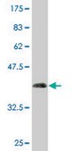 Monoclonal Anti-NPC2 antibody produced in mouse clone 4B9, purified immunoglobulin, buffered aqueous solution