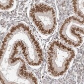 Anti-NUP153 antibody produced in rabbit Prestige Antibodies&#174; Powered by Atlas Antibodies, affinity isolated antibody, buffered aqueous glycerol solution, ab2