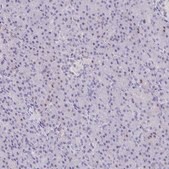 Anti-FCGR3A antibody produced in rabbit Prestige Antibodies&#174; Powered by Atlas Antibodies, affinity isolated antibody, buffered aqueous glycerol solution