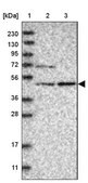 Anti-NT5DC1 antibody produced in rabbit Prestige Antibodies&#174; Powered by Atlas Antibodies, affinity isolated antibody, buffered aqueous glycerol solution