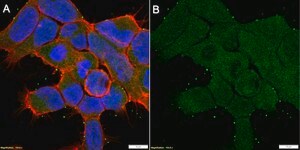 Anti-CaM Kinase II β Antibody, clone 1F13 ZooMAb® Rabbit Monoclonal recombinant, expressed in HEK 293 cells