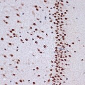 Anti-ACTL6A Antibody, clone 5U6J8, Rabbit Monoclonal