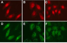 LentiBrite RFP-LC3 Control Mutant Lentiviral Biosensor