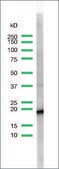 Anti-CD3 antibody, Rabbit monoclonal clone SP7, recombinant, expressed in proprietary host, tissue culture supernatant