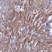 Anti-ADO antibody produced in rabbit Prestige Antibodies&#174; Powered by Atlas Antibodies, affinity isolated antibody, buffered aqueous glycerol solution