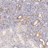 Anti-MYO5A antibody produced in rabbit Prestige Antibodies&#174; Powered by Atlas Antibodies, affinity isolated antibody, buffered aqueous glycerol solution