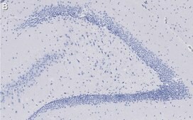Anti-C9ORF72 (long form) Antibody, clone 1I9 ZooMAb® Rabbit Monoclonal recombinant, expressed in HEK 293 cells