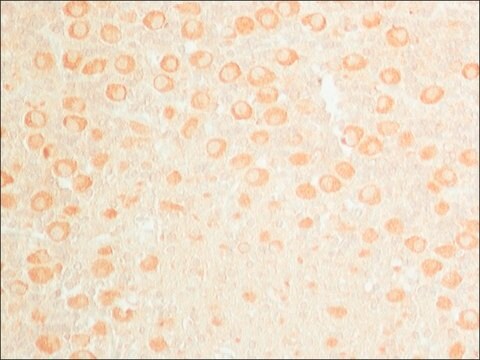 Anti-Heat Shock Protein 110 (HD-19) antibody produced in rabbit affinity isolated antibody, buffered aqueous solution