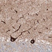 Anti-HECW2 antibody produced in rabbit Prestige Antibodies&#174; Powered by Atlas Antibodies, affinity isolated antibody, buffered aqueous glycerol solution