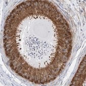 Anti-CDK5RAP3 antibody produced in rabbit Prestige Antibodies&#174; Powered by Atlas Antibodies, affinity isolated antibody, buffered aqueous glycerol solution, Ab1